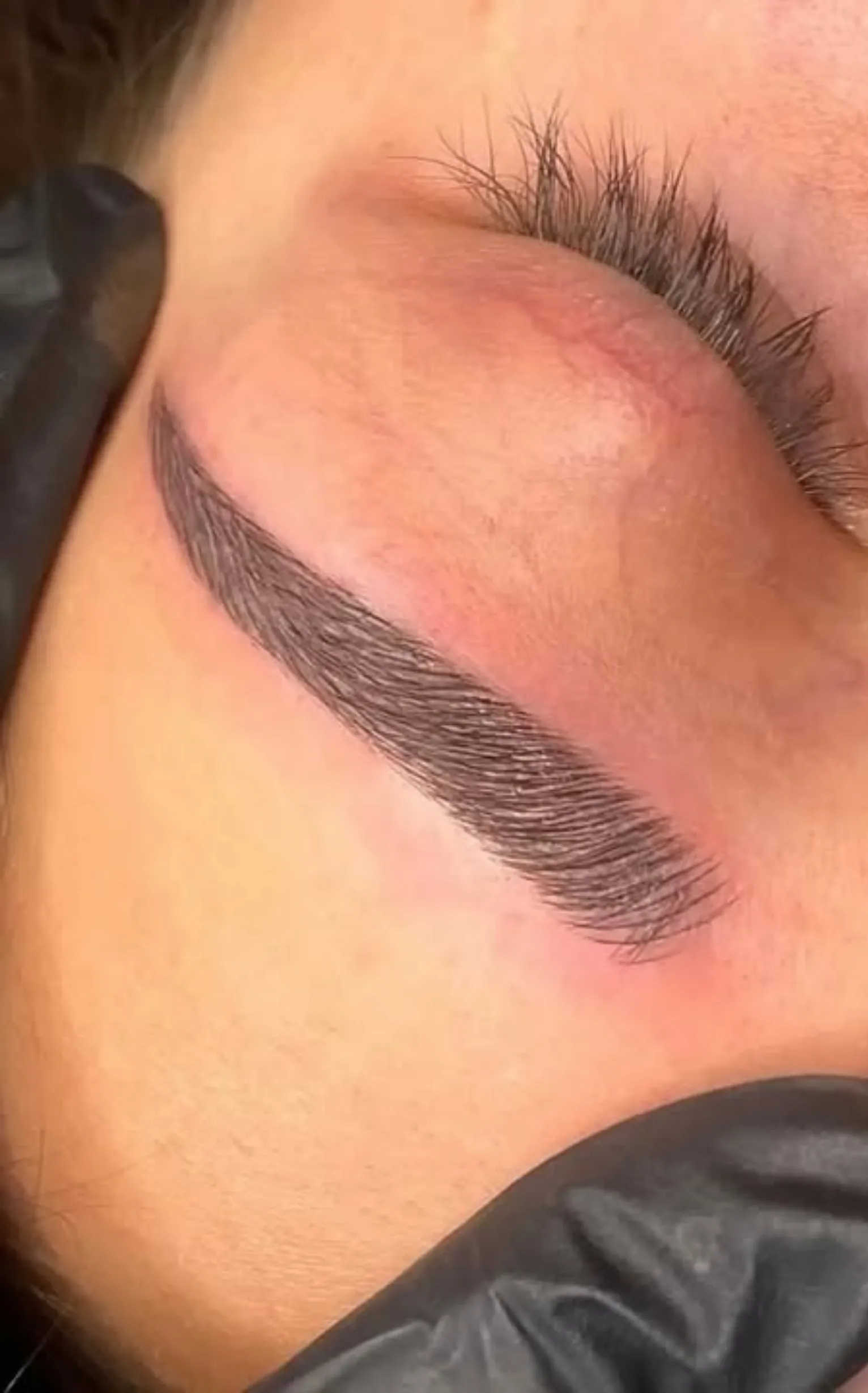 pigment retention with retinoids