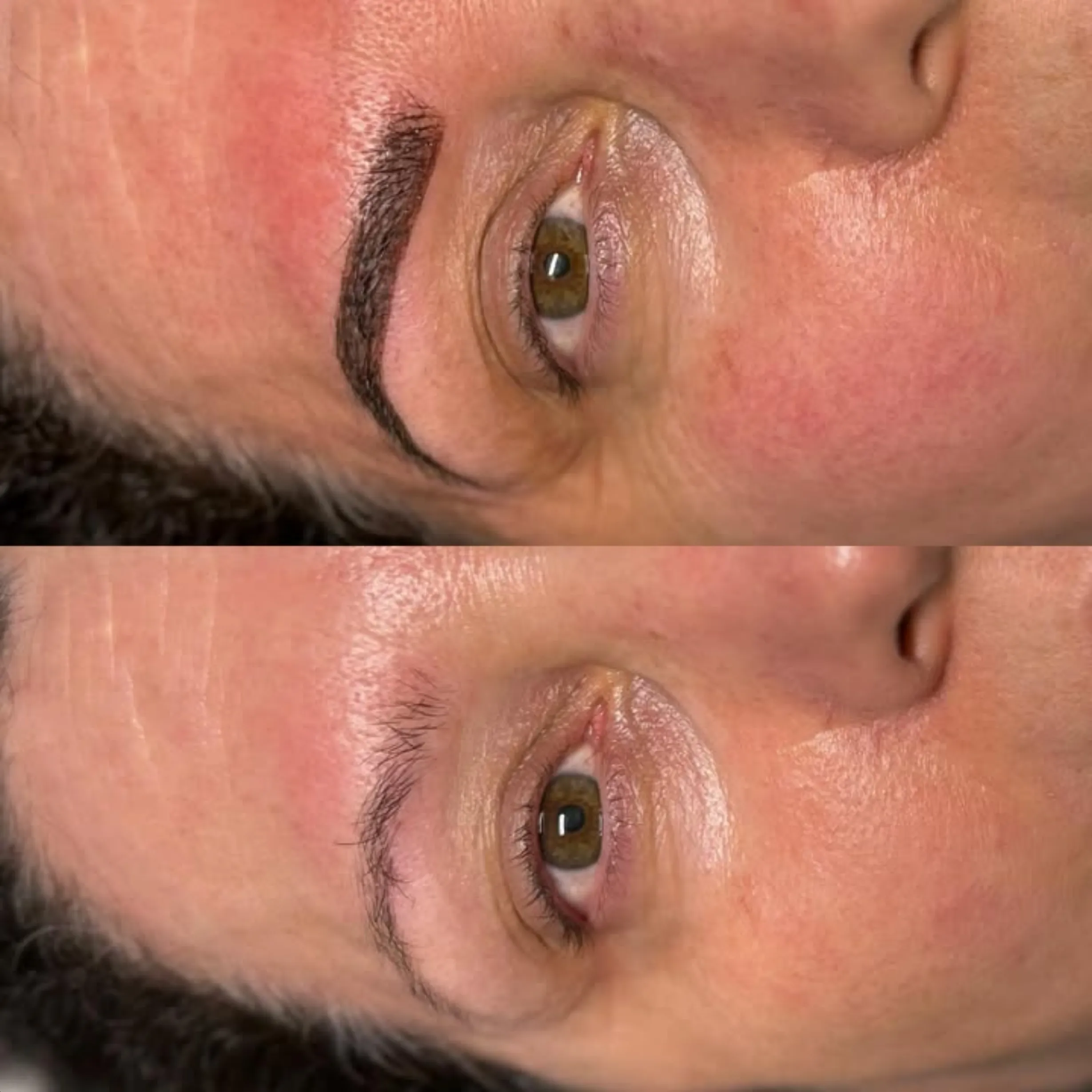 eyebrow tattoo and tretinoin