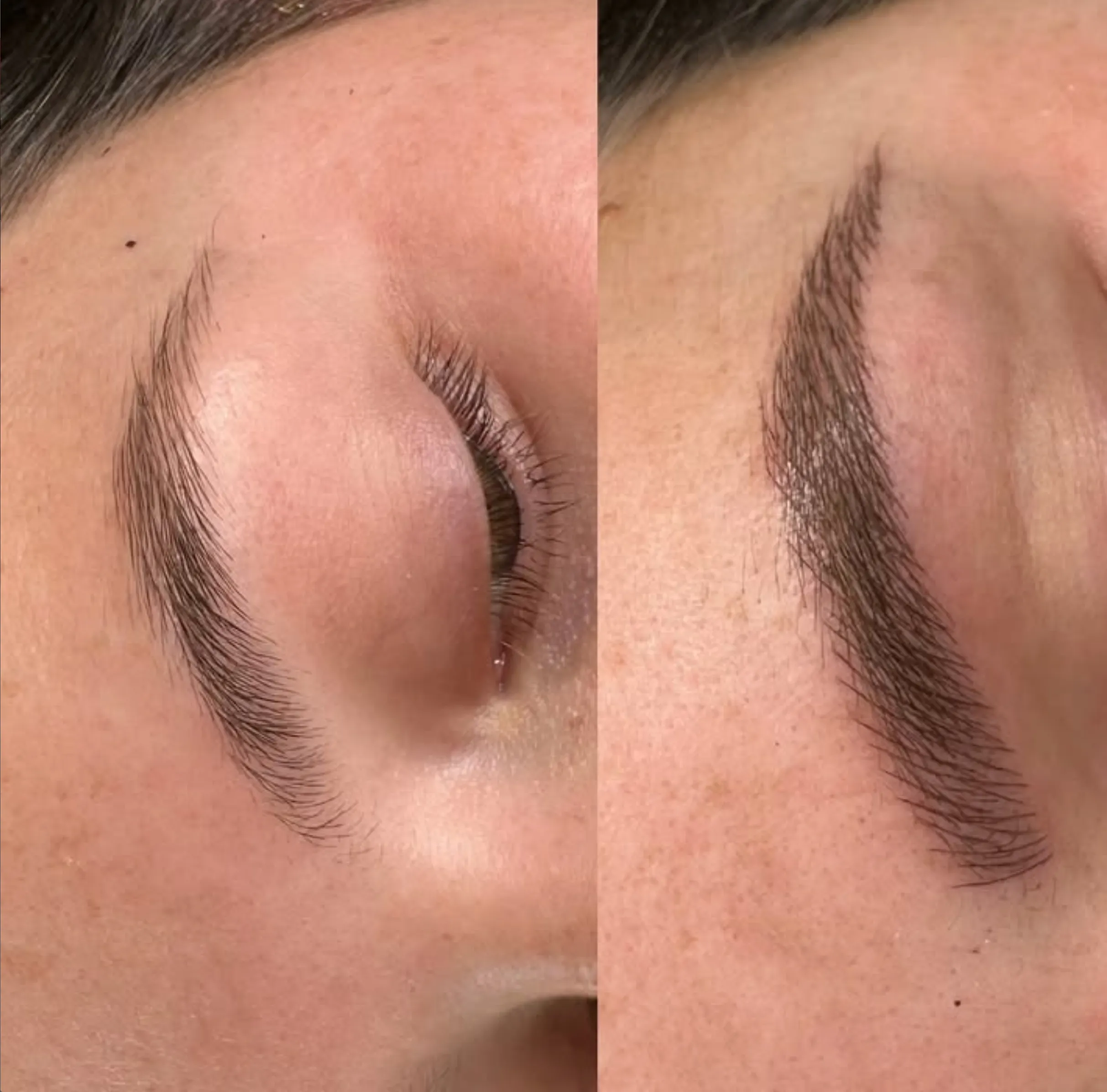 microblading with retinoids safety