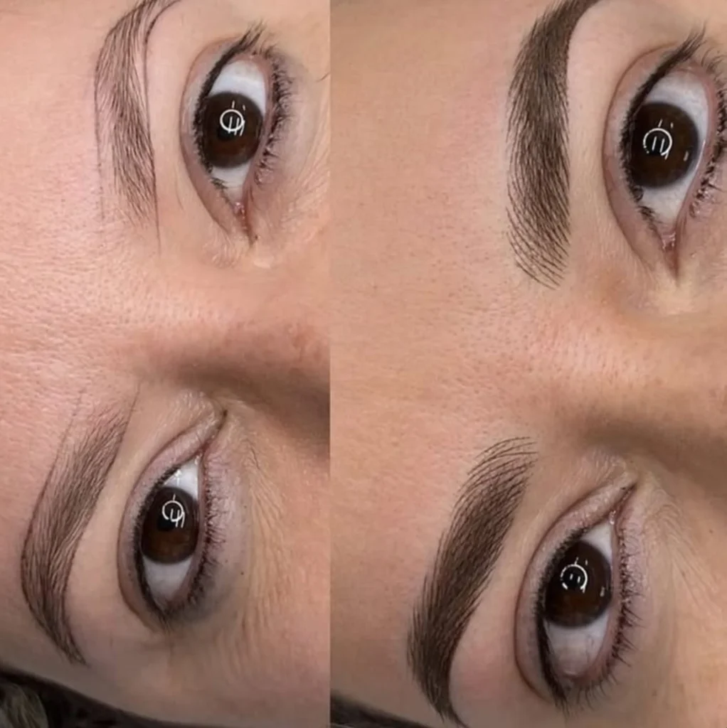 microblading and tretinoin